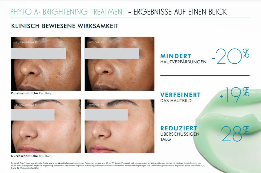 Alt-Text: Bild zeigt Ergebnisse einer klinischen Studie fur eine aufhellende Behandlung, mit Vorher-Nachher-Fotos, die eine Reduktion von Hautverfarbungen, Verbesserungen des Hautbildes und eine Verringerung der Talgproduktion darstellen.