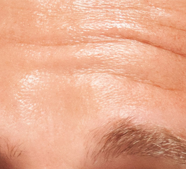 Nahaufnahme einer menschlichen Stirn mit leicht sichtbaren Falten und Hauttextur.