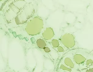 Mikroskopische Ansicht von grunen Zellstrukturen mit variierenden Formen und Großen in einem hellgrunen Hintergrund.
