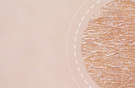 Close-up of textured skin showing fine lines and wrinkles on a soft, muted background.