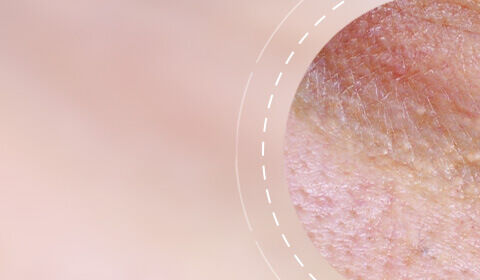 Close-up of skin texture showing fine lines and slight imperfections, set against a soft pink background.