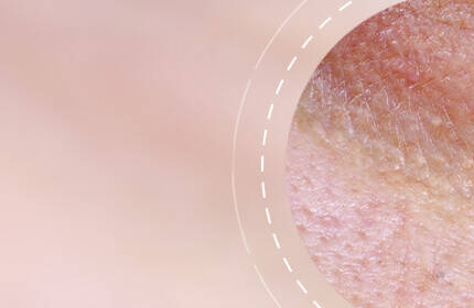 Close-up of skin texture showing fine lines and slight imperfections, set against a soft pink background.