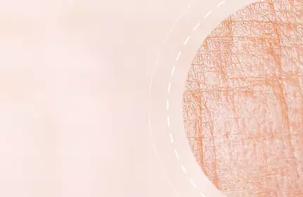A soft, textured background with a round, light orange area featuring subtle lines and patterns, resembling natural skin or a surface with fine details.