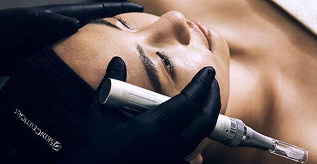 A person receiving a microneedling treatment at a spa, with a professional using a device on their face.