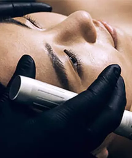 A person receiving a microneedling treatment at a spa, with a professional using a device on their face.