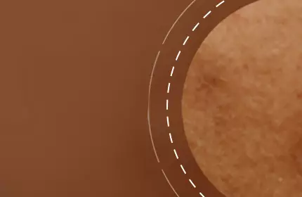 Close-up of skin texture showing a warm brown tone with subtle imperfections.