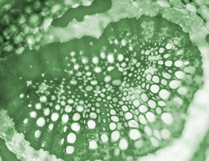 Mikroskopische Nahaufnahme von grunem Pflanzengewebe mit charakteristischen Zellstrukturen und Mustern.