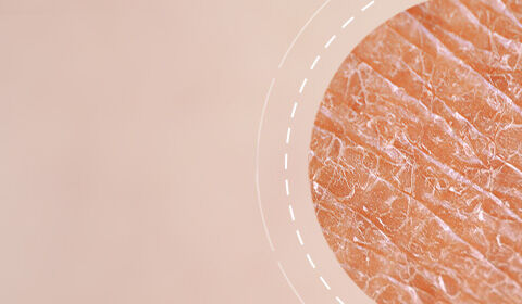 Close-up of textured skin with a soft, neutral background.