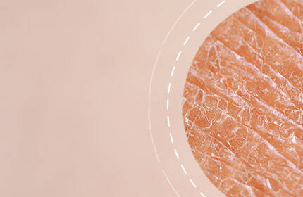 Close-up of textured skin with a soft, neutral background.