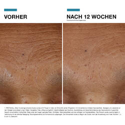 Hyaluronic Acid Intensifier Multi-Glycan