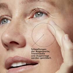 A.G.E. Eye Complex